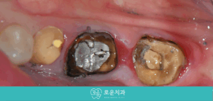 용호동치과