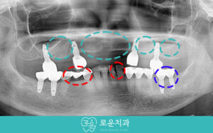 부산용호동보철치료