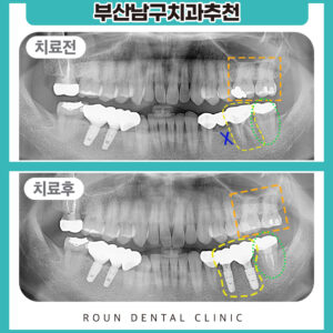 앞표지