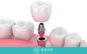 부산용호동치과