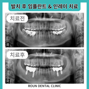 제목을-입력해주세요_-002_(20)