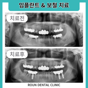 제목을-입력해주세요_-001_-_2026-04-15T103222.404