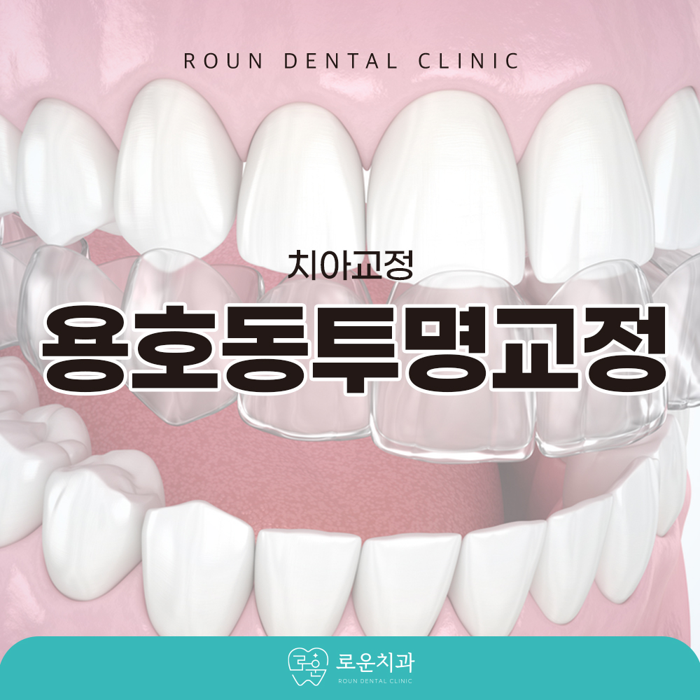 용호동투명교정